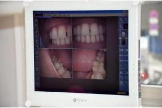 Servicii implantologie de la Cmi Dr Eduard Nica Dental Practice