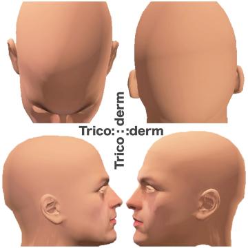 Workshop Masterclass - micropigmentare scalp - TricoDerm de la Trico Derm Srl